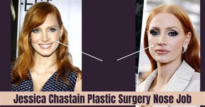 Jessica Chastain | Nose Surgery